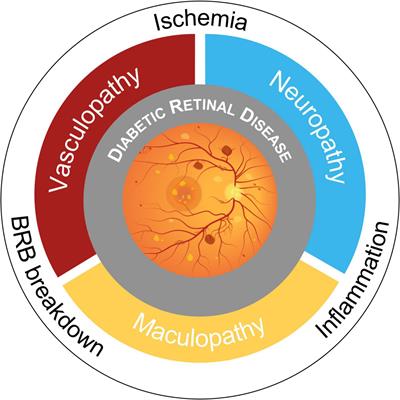 Neuroinflammation and neurodegeneration in diabetic retinopathy